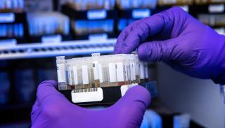 Gloved hands holding patient samples for testing